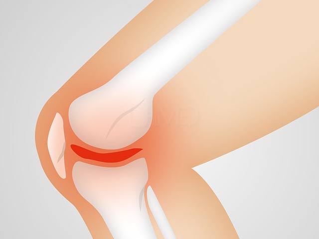 Surgery for knee pain