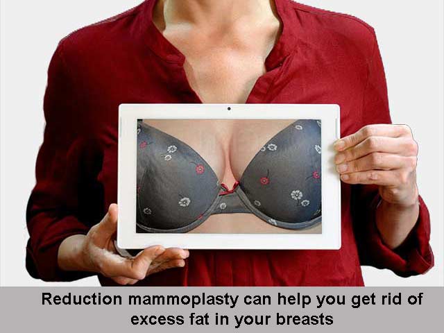 Candidates for breast reduction surgery