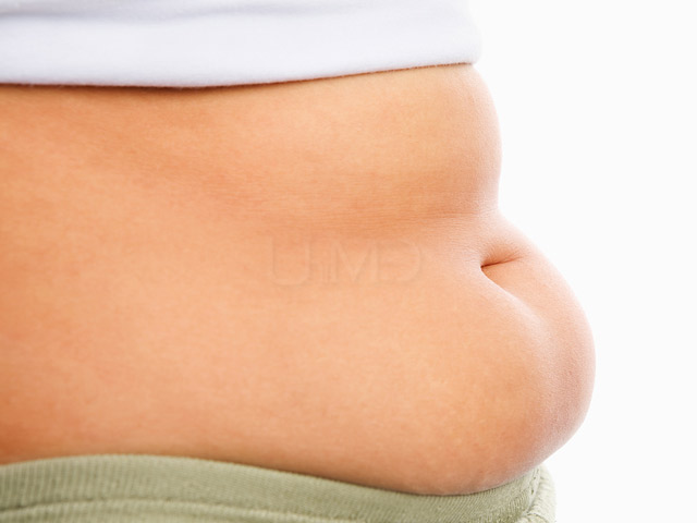 Affordable tummy tuck abroad